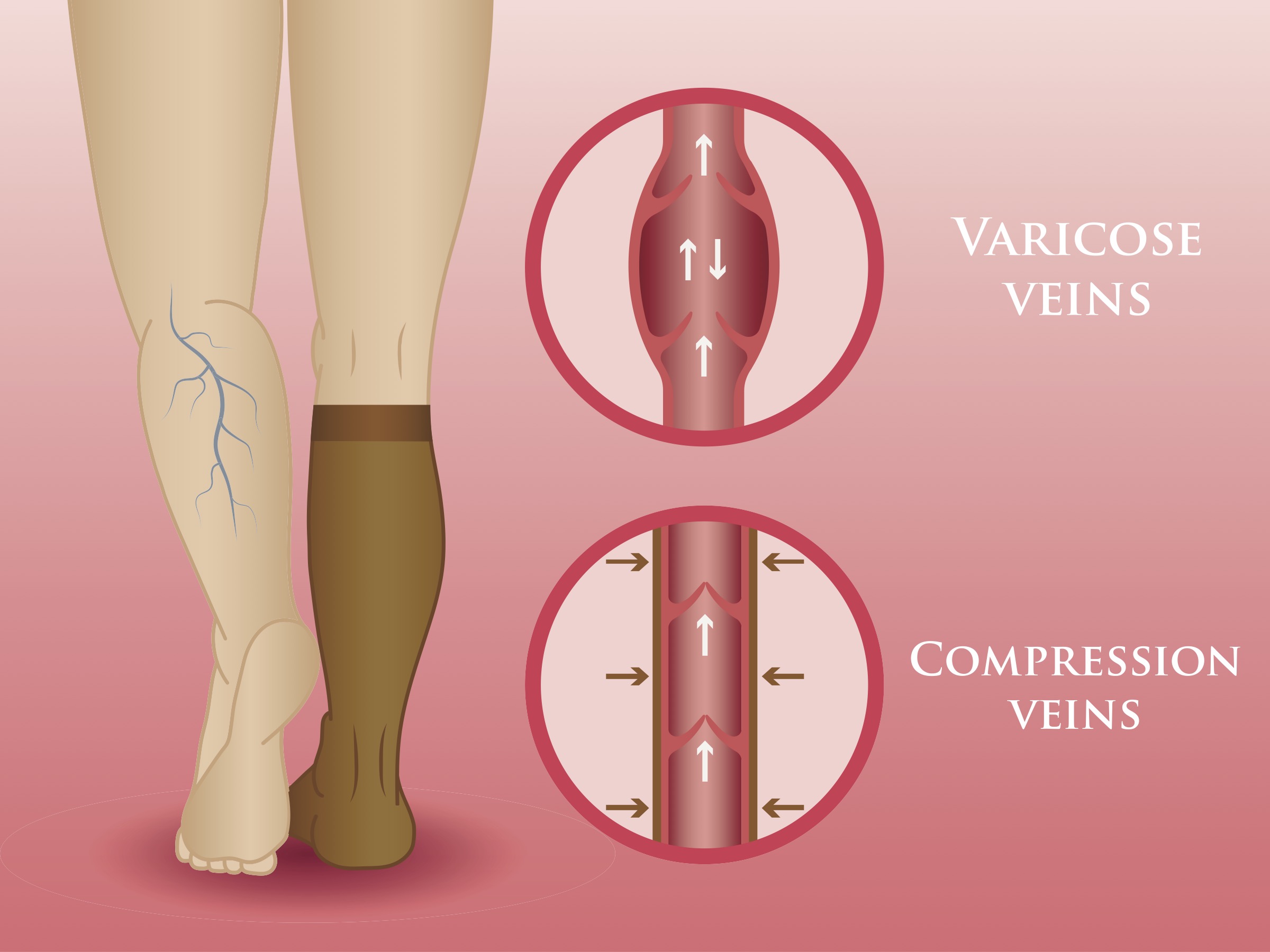 Compression Stockings, Compression Hosiery
