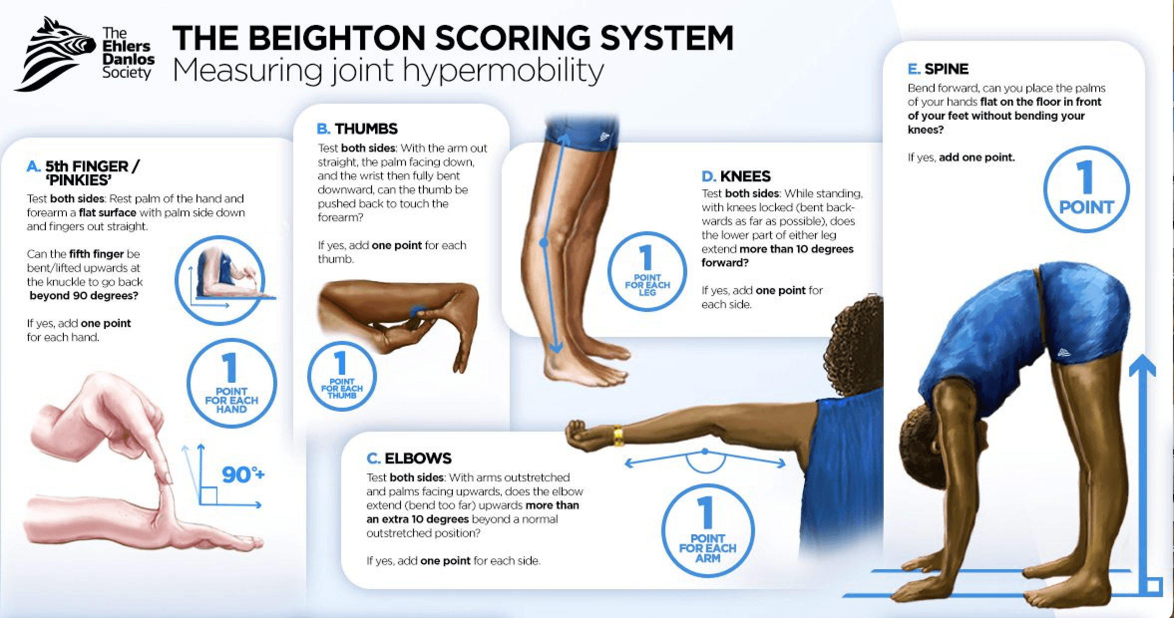 Ehlers-Danlos Syndrome (EDS): Key Facts and Insights