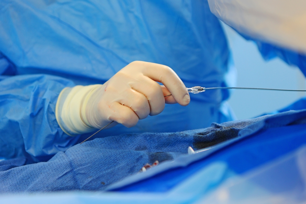 Vascular,Specialist,Performs,Varicose,Vein,Treatment