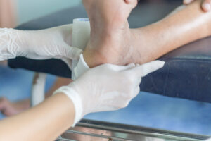 Venous,Ulcer,Diabetic,Ulcer,Wound,Dressing,By,Nurse
