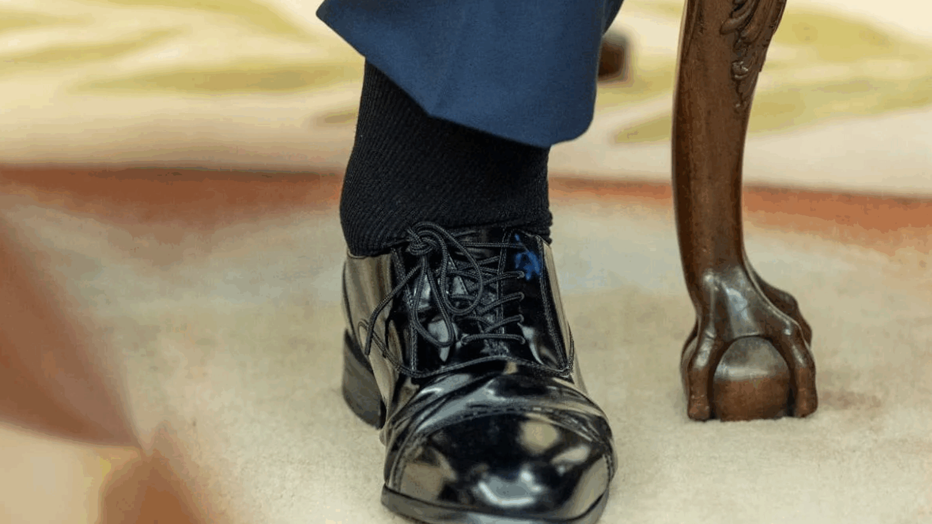 Donald,Trump,One,Leg,Showing,Swollen,Ankles